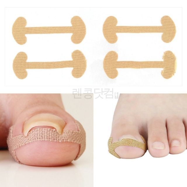 발톱보호밴드 파고드는발톱보호 발톱 보호테이프