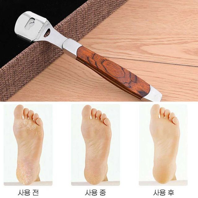 여름철 발뒤꿈치 페디 큐어 발각질 콘커터 관리 용품